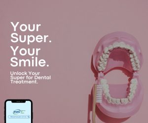 Release Super for dental